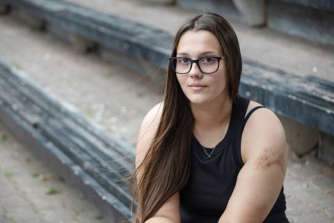 Tamara Jeremić zeigt ihre Verletzung am Oberarm