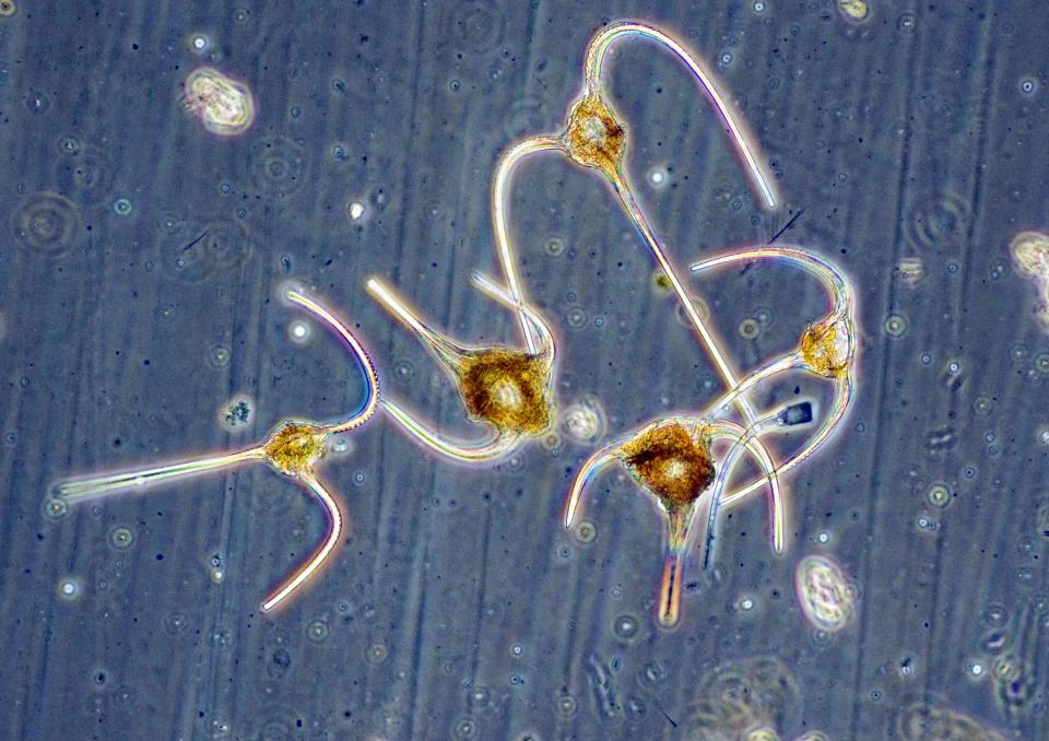 Mikroskopische Aufnahme von Dinoflagellaten der Gattung Ceratium
